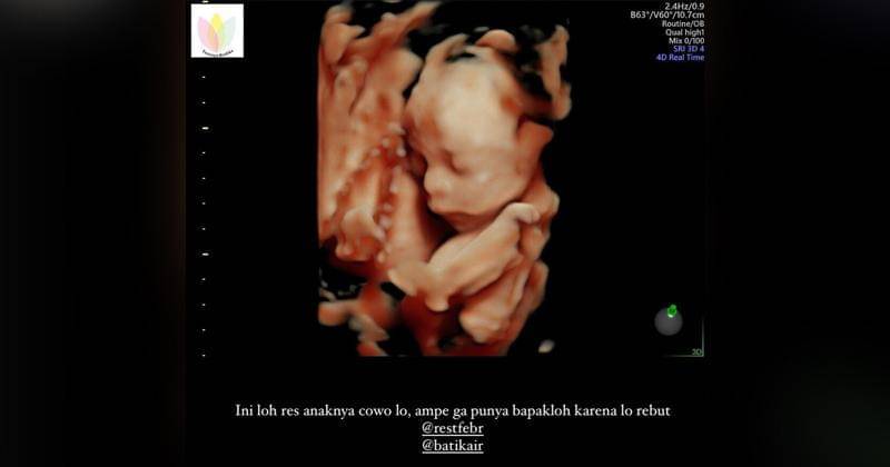 Instagram.com/rimaadona